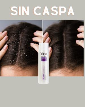 TAHE Detox Shampoo anticaspa 300 ML.