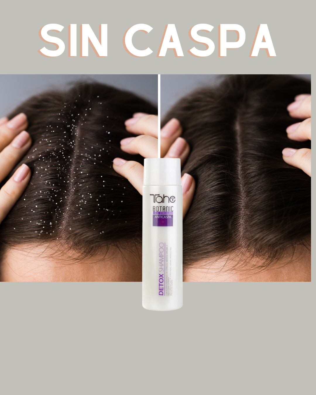 TAHE Detox Shampoo anticaspa 300 ML.