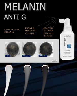 Con la Locion Capilar de Melanin Capissen Seras un Hombre que le dira Adios a las Canas